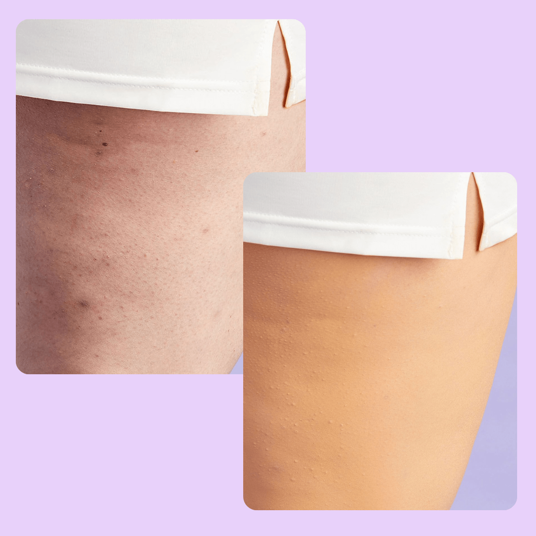 BodyLux Perfector