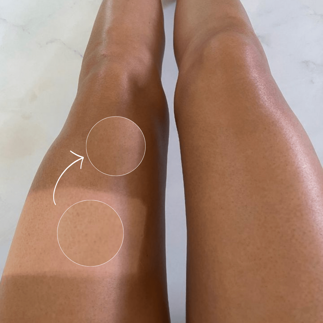 BodyLux Perfector