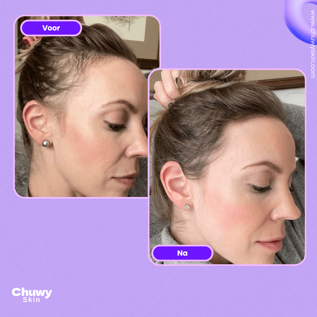 Chuwy HairGlo™