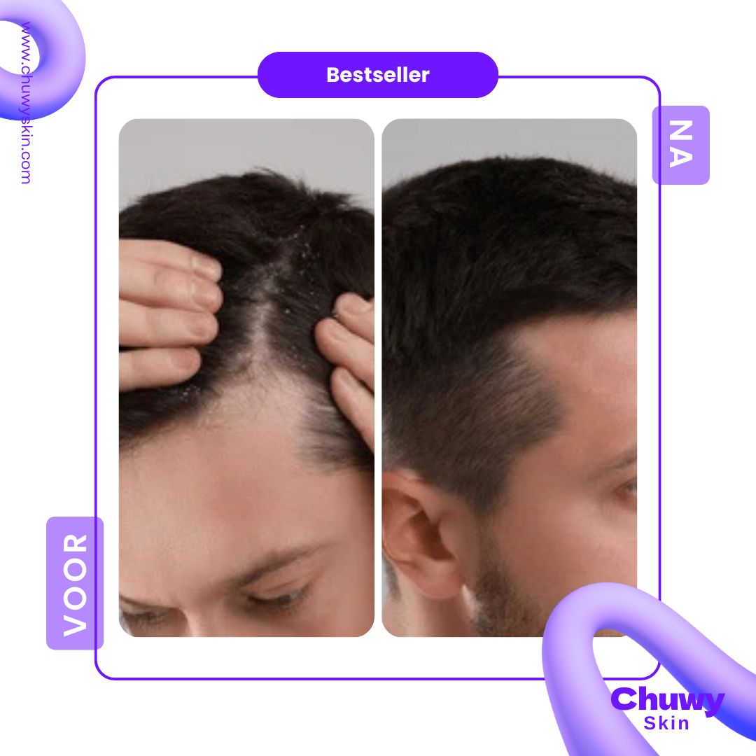 Scalp Comb