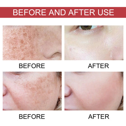 Pigmentatie Corrector Serum 30ml (Niacinamide 10% + TXA 4%)