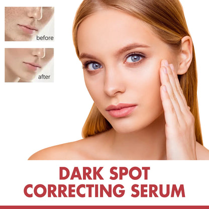 Pigmentatie Corrector Serum 30ml (Niacinamide 10% + TXA 4%)