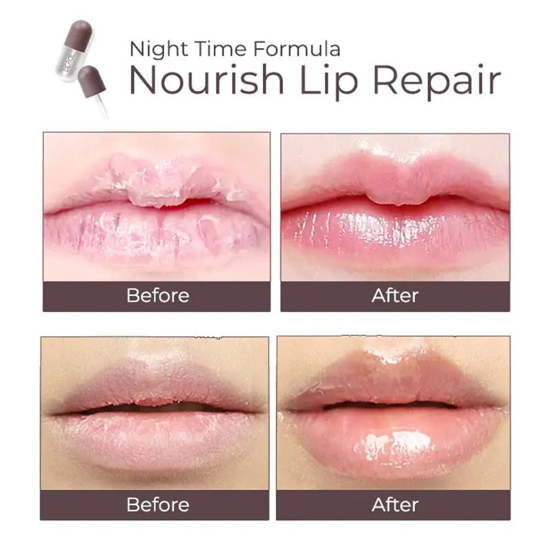 Lip Plumper - dag & nacht