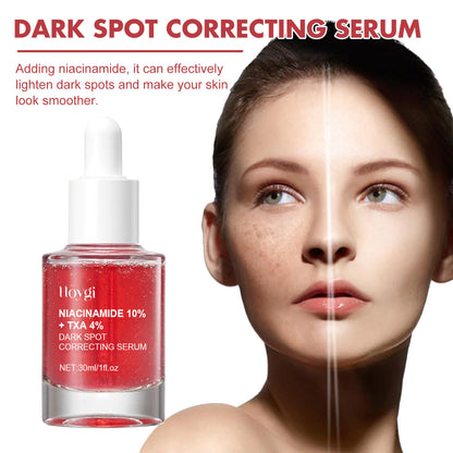 Pigmentatie Corrector Serum 30ml (Niacinamide 10% + TXA 4%)